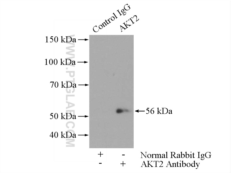 IP experiment of HepG2 using 17609-1-AP