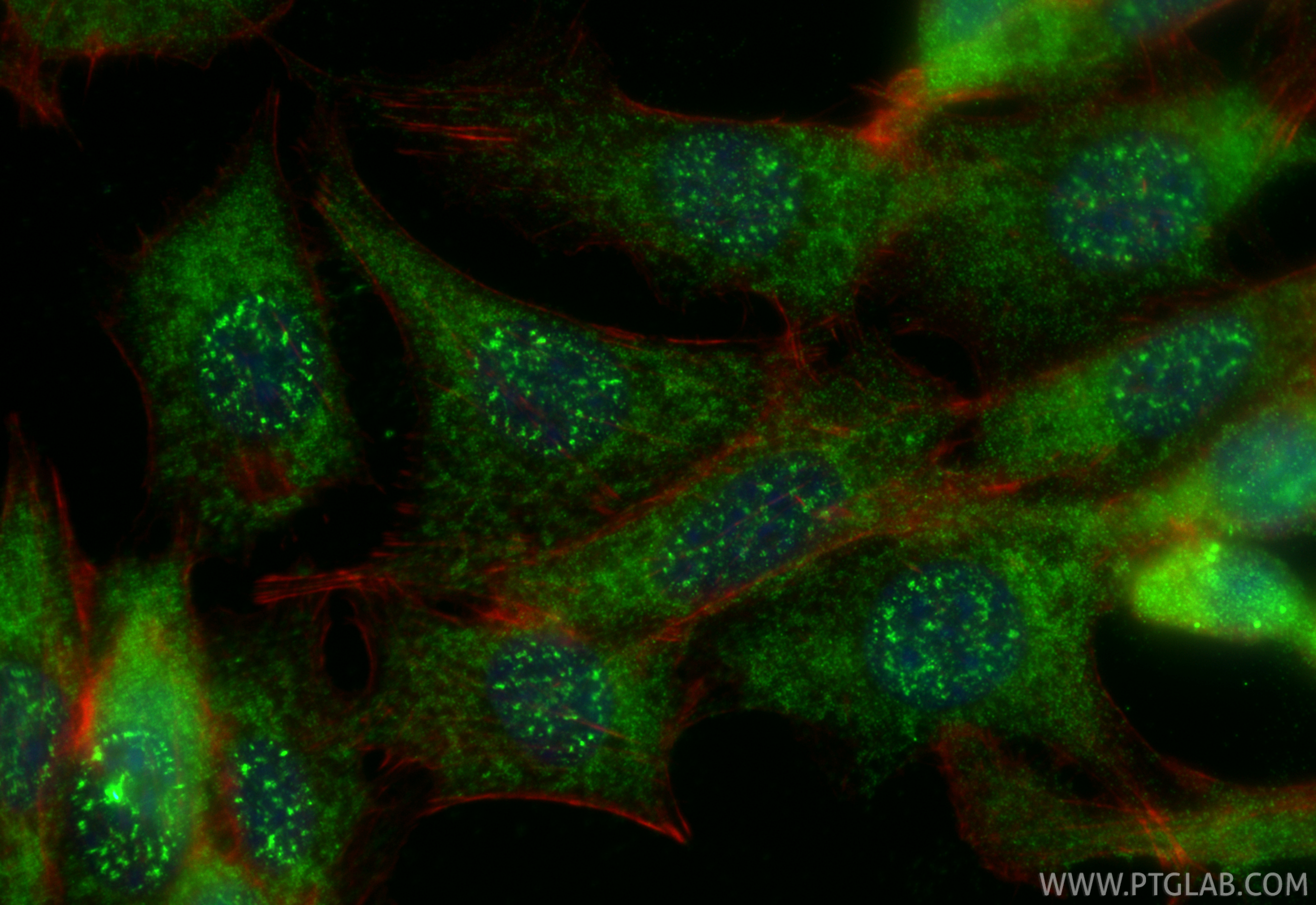 IF Staining of NIH/3T3 using 14860-1-AP
