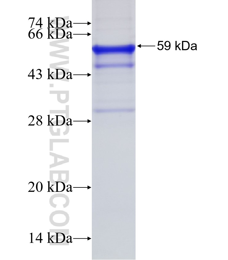 AKTIP fusion protein Ag6662 SDS-PAGE