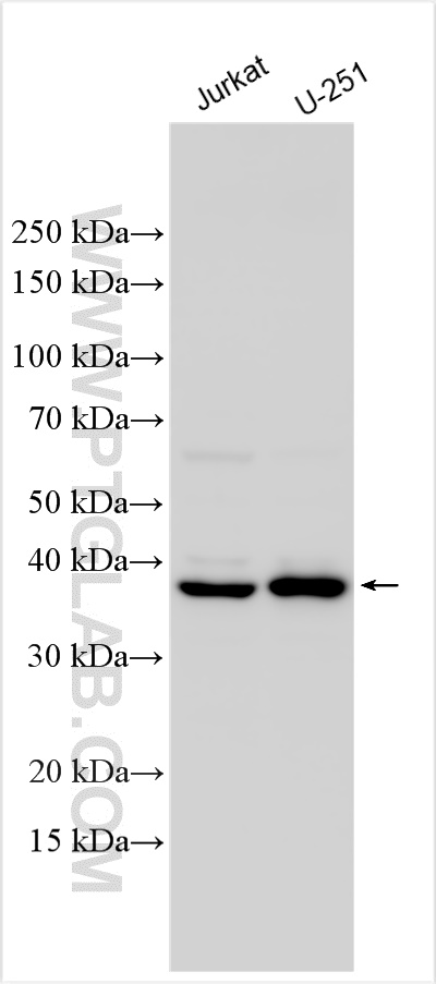 WB analysis using 31686-1-AP