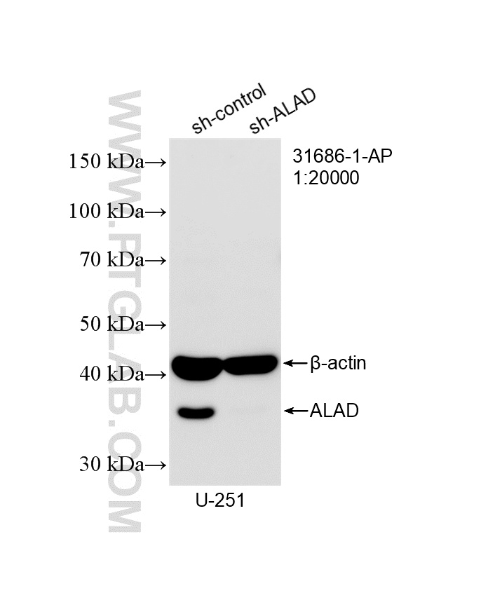 WB analysis of U-251 using 31686-1-AP WB analysis of U-251 using 31686-1-AP