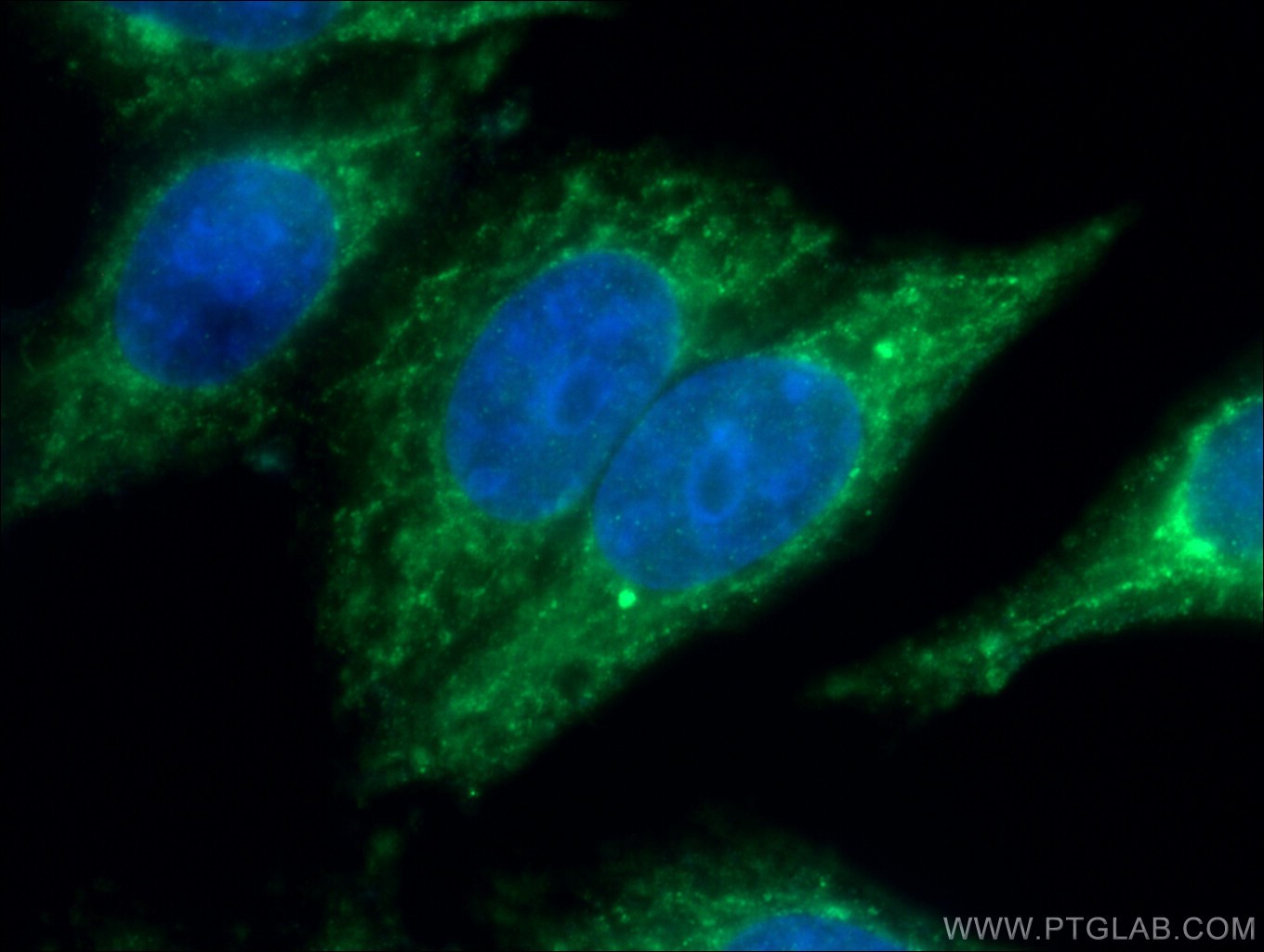 IF Staining of HepG2 using 16200-1-AP