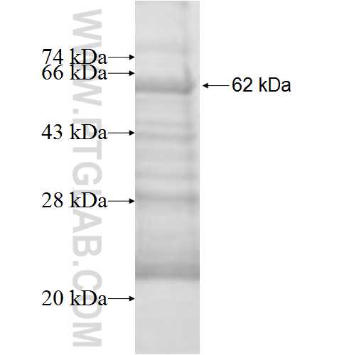ALAS1 fusion protein Ag9126 SDS-PAGE