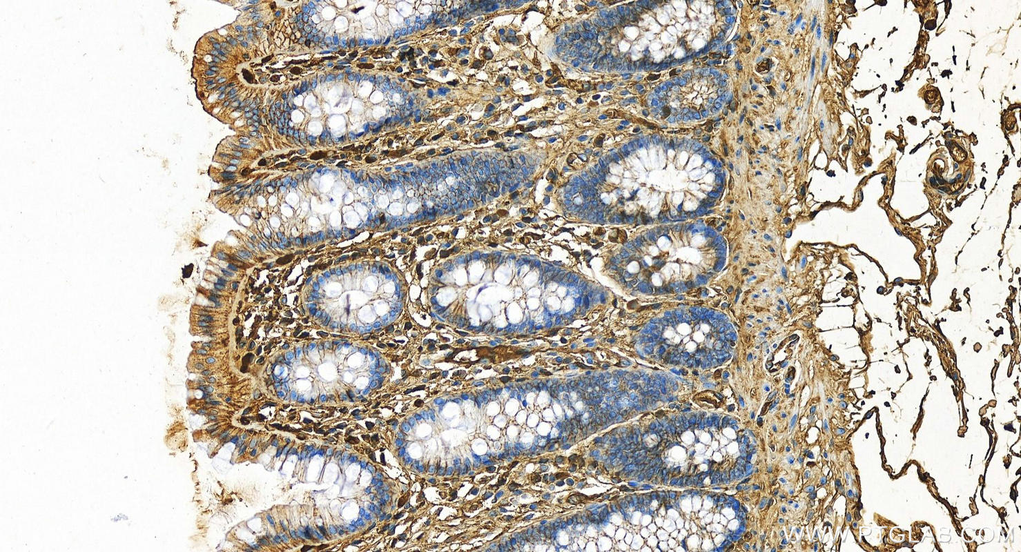 IHC staining of human colon using 16475-1-AP