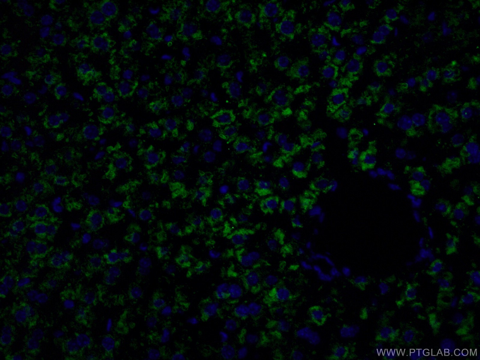 IF Staining of mouse liver using 16475-1-AP