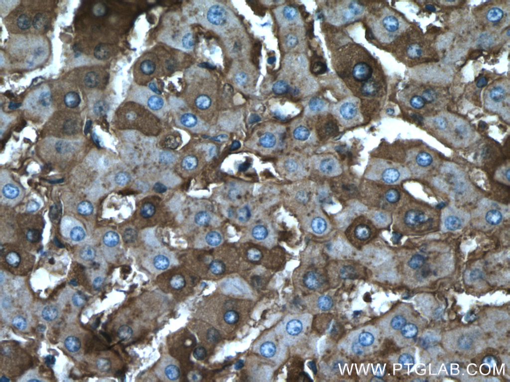 IHC staining of human liver using 16475-1-AP