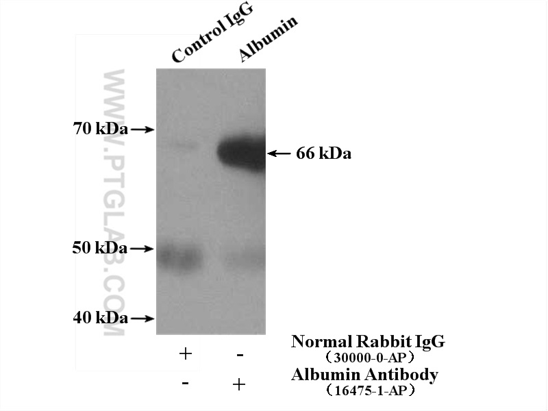 IP experiment of human plasma using 16475-1-AP