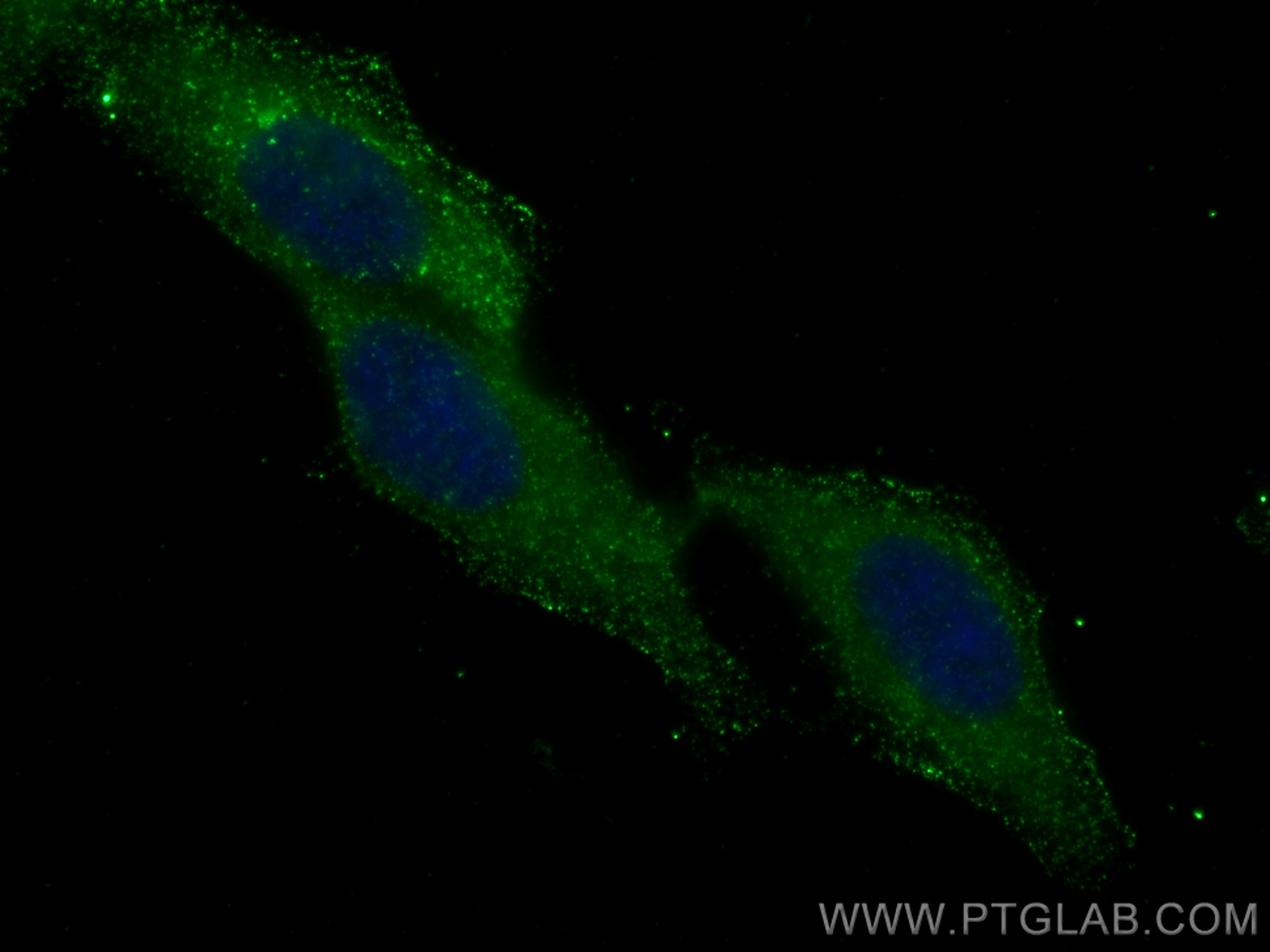 IF Staining of HepG2 using 66051-1-Ig