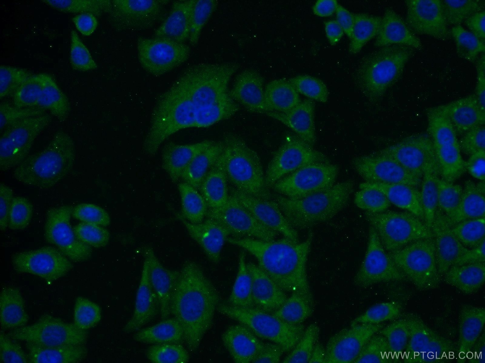 Albumin Monoclonal antibody