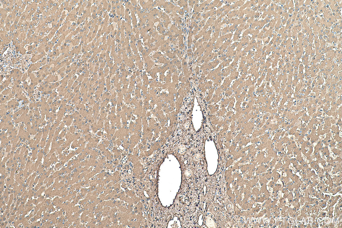 IHC staining of human liver using 66051-1-Ig