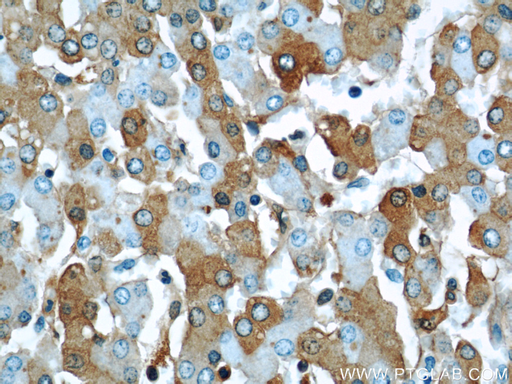 IHC staining of human liver using 66051-1-Ig