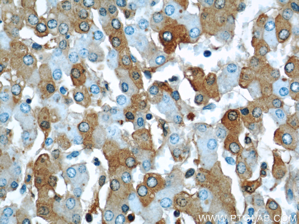 Albumin Monoclonal antibody