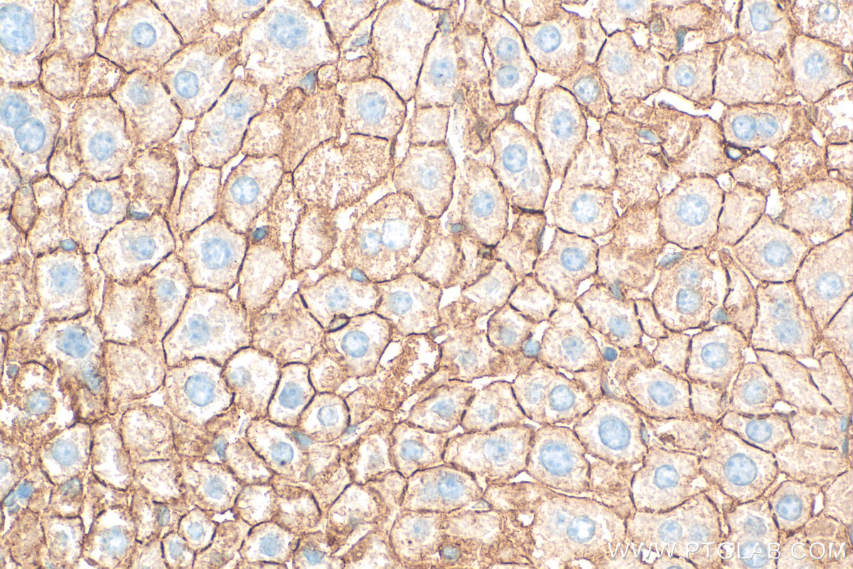 IHC staining of mouse liver using 32402-1-AP