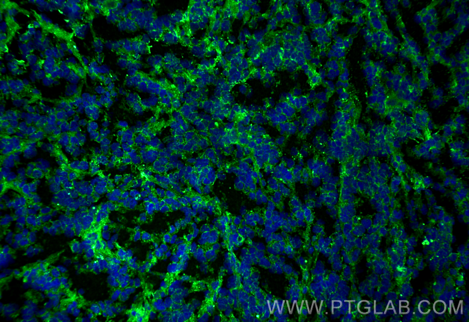 IF Staining of mouse breast cancer using 67768-1-Ig