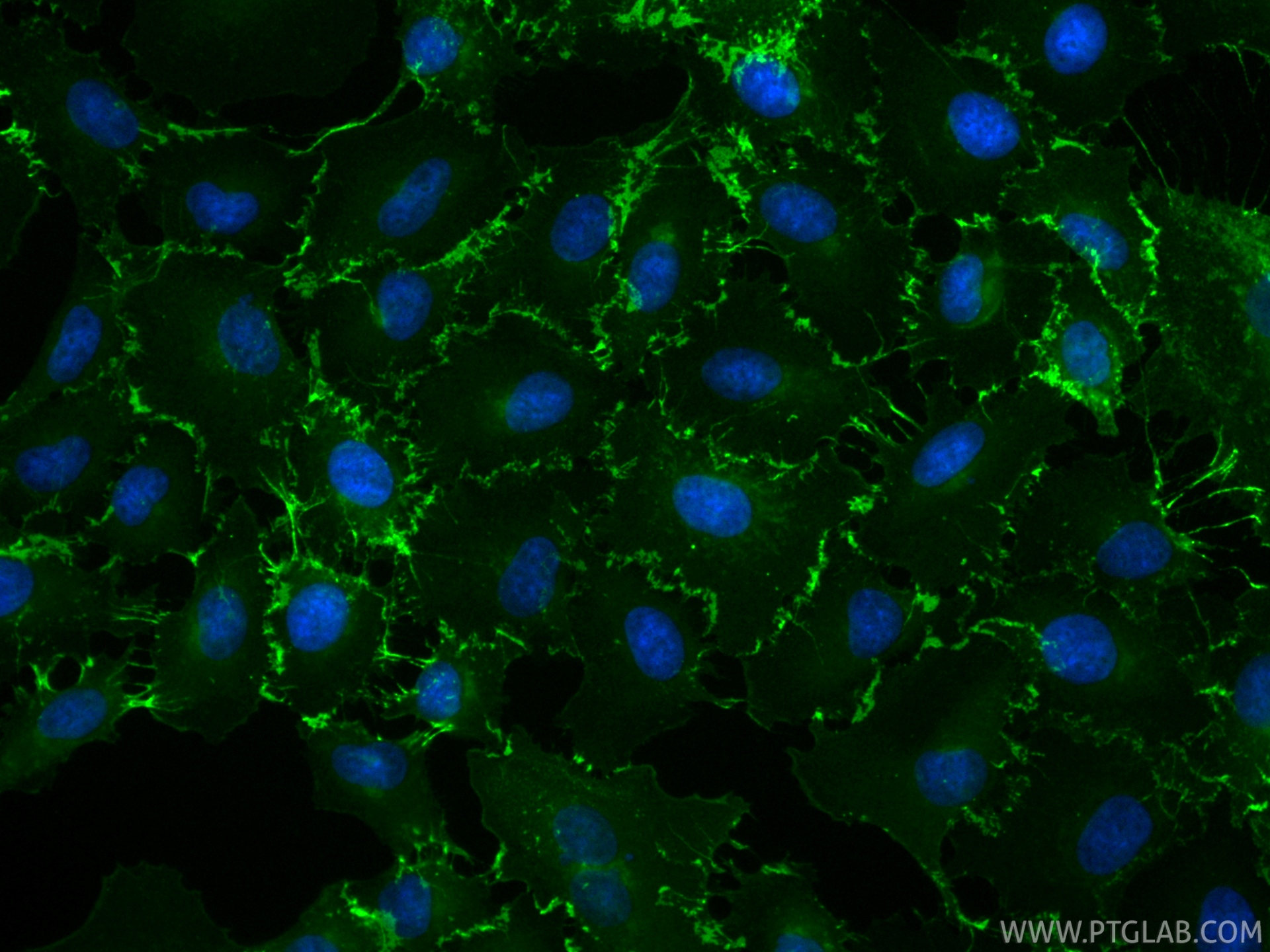 IF Staining of A549 using CL488-86811-3