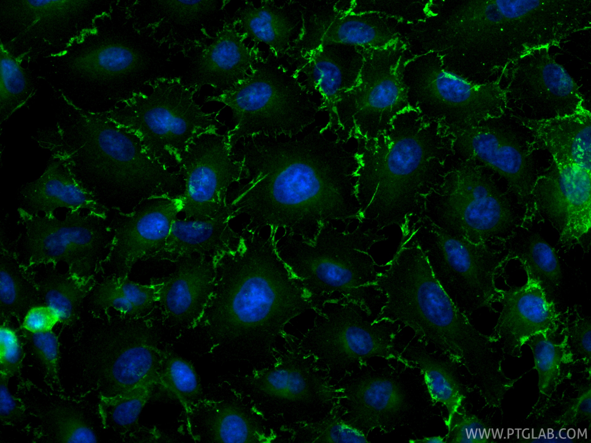 IF Staining of A549 using CL488-86811 IF Staining of A549 using CL488-86811