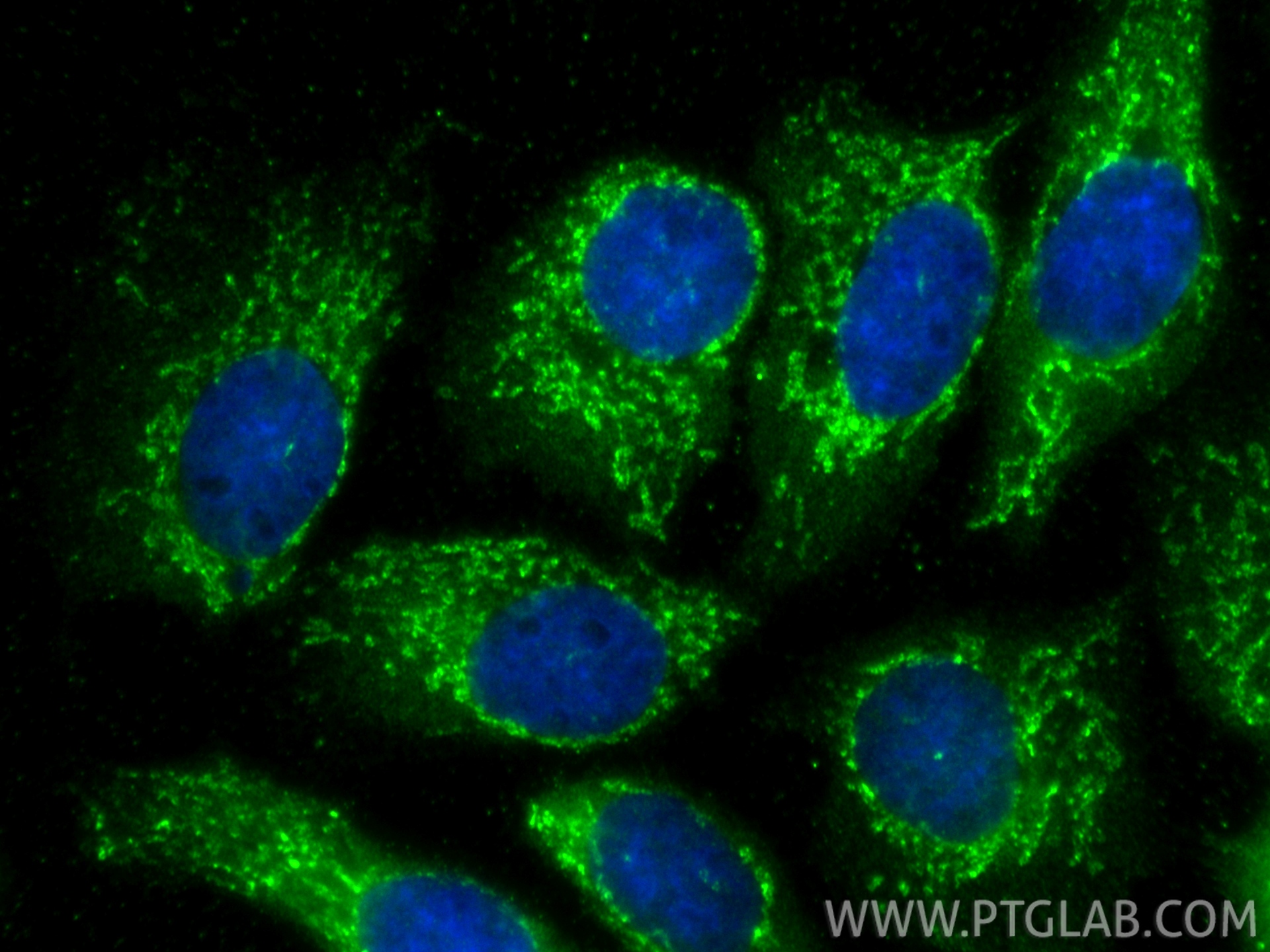 Immunofluorescent analysis of (-20°C Methanol) fixed A431 cells using P5CS antibody (17719-1-AP) at dilution of 1:400 and CoraLite®488-Conjugated Goat Anti-Rabbit IgG(H+L) (<a class='green' href='/productredirect?CatalogNo=SA00013-2' target='_blank'>SA00013-2</a>). IF Staining of A431 using 17719-1-AP