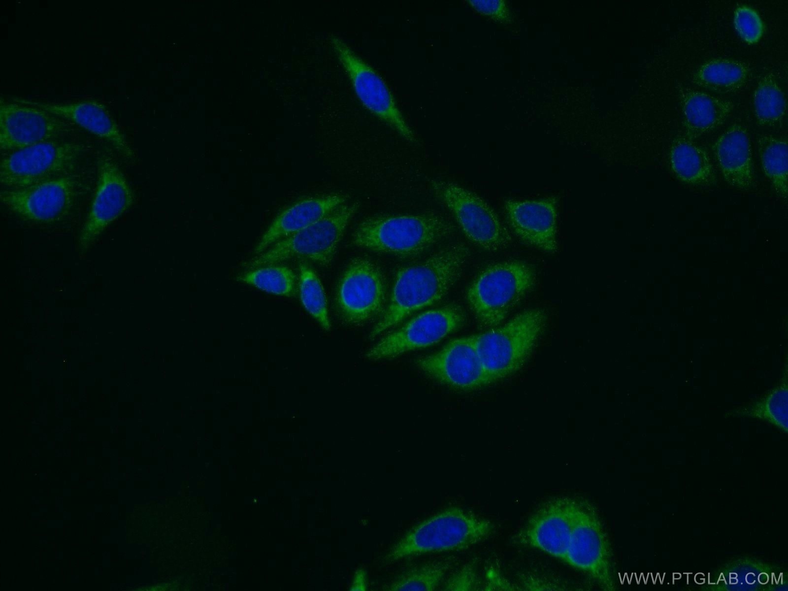 ALDH1A1 Polyclonal antibody