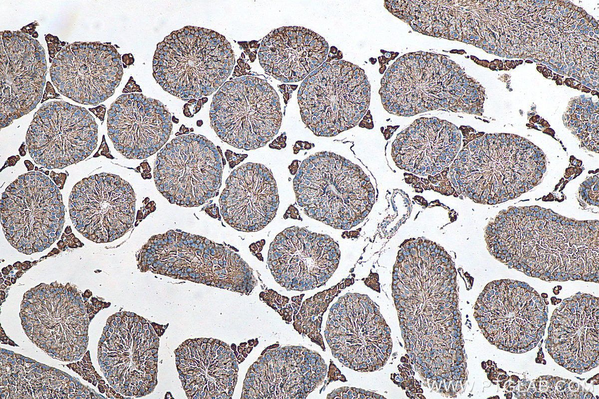 IHC staining of mouse testis using 15910-1-AP