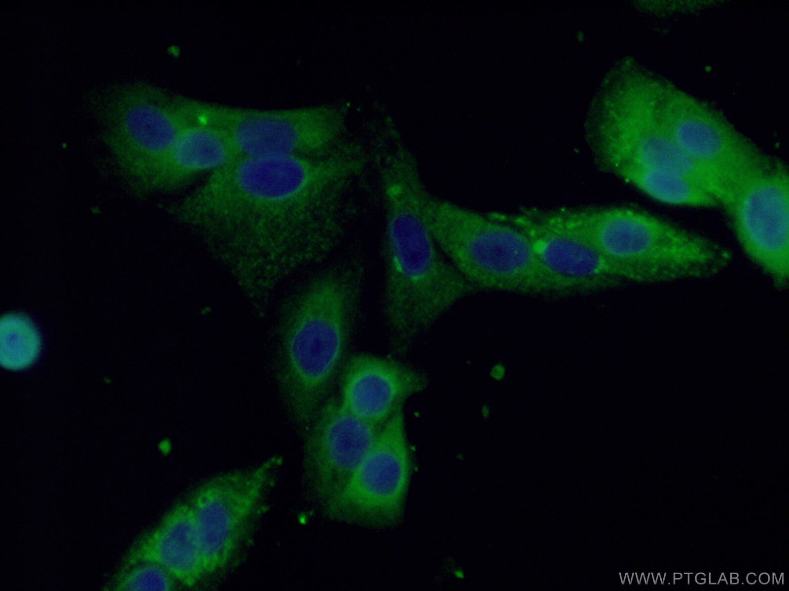 ALDH1A1-specific