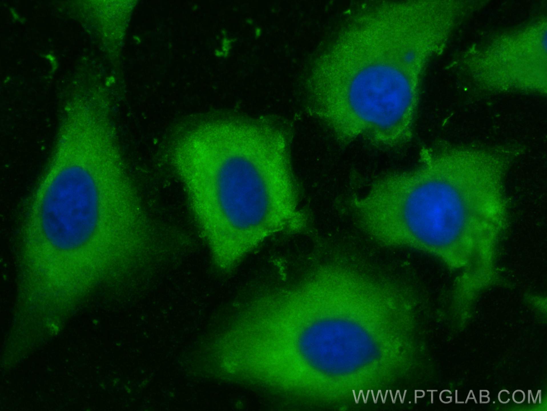 IF Staining of A549 using 22109-1-AP