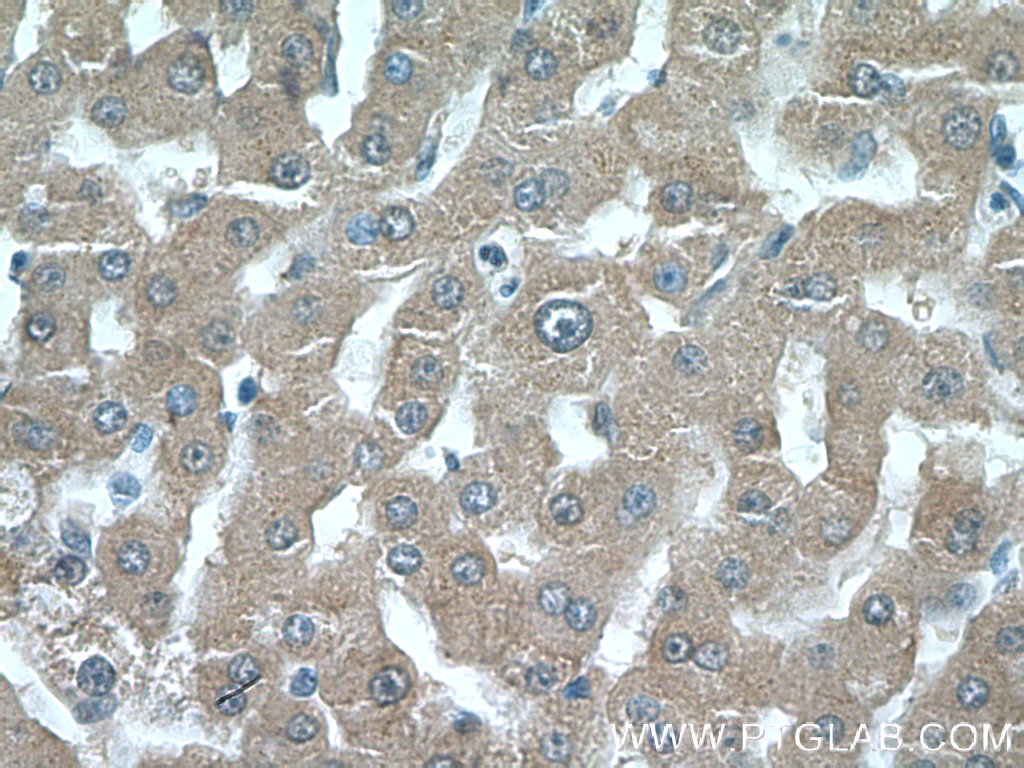 IHC staining of human liver using 22109-1-AP