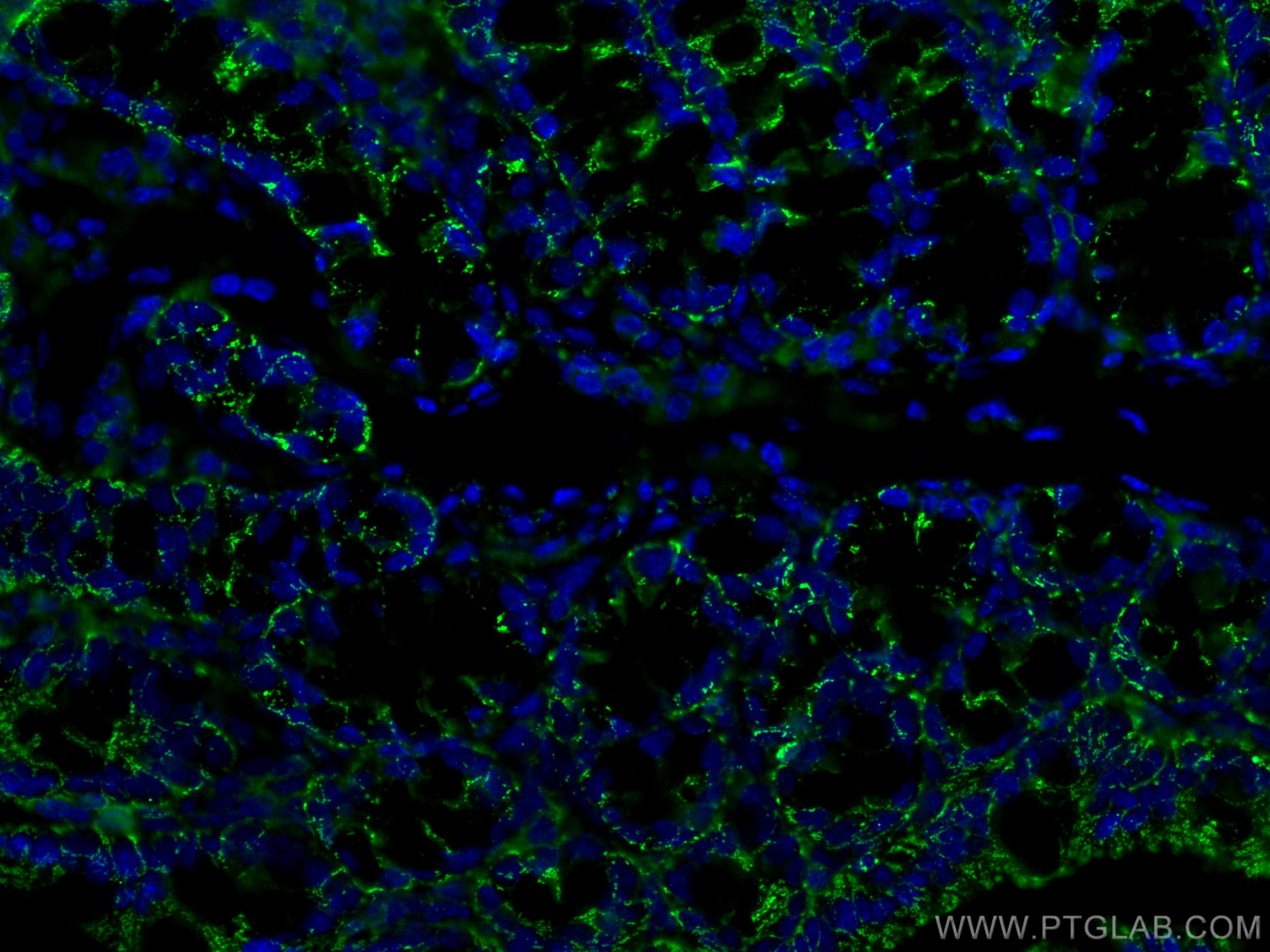 IF Staining of mouse colon using 60171-1-Ig (same clone as 60171-1-PBS)