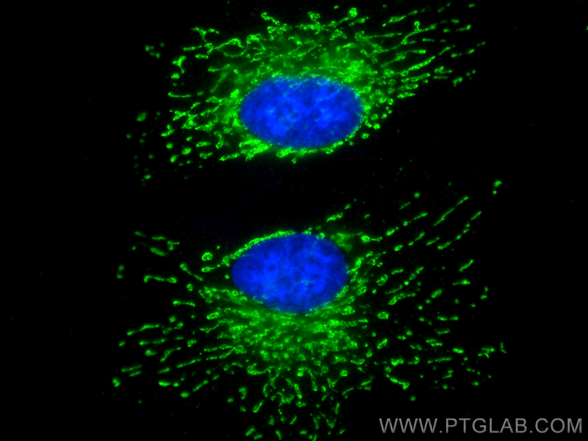 IF Staining of HeLa using 60171-1-Ig (same clone as 60171-1-PBS)