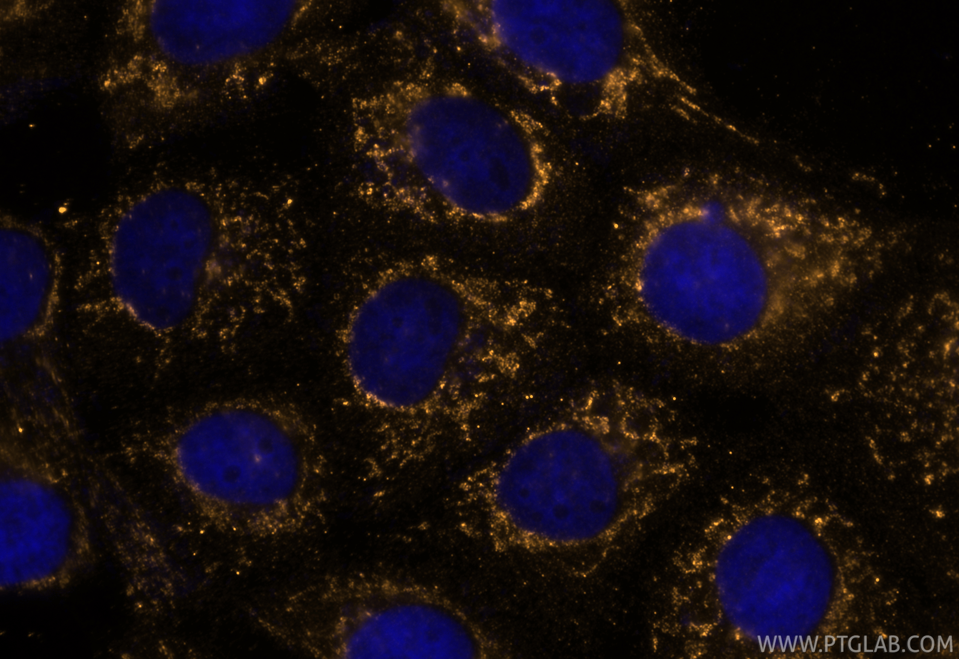 Immunofluorescent analysis of (-20°C Methanol) fixed A431 cells using CoraLite® Plus 555 ALDH1A1 antibody (CL555-60171, Clone: 1A10A2 ) at dilution of 1:200. IF Staining of A431 using CL555-60171