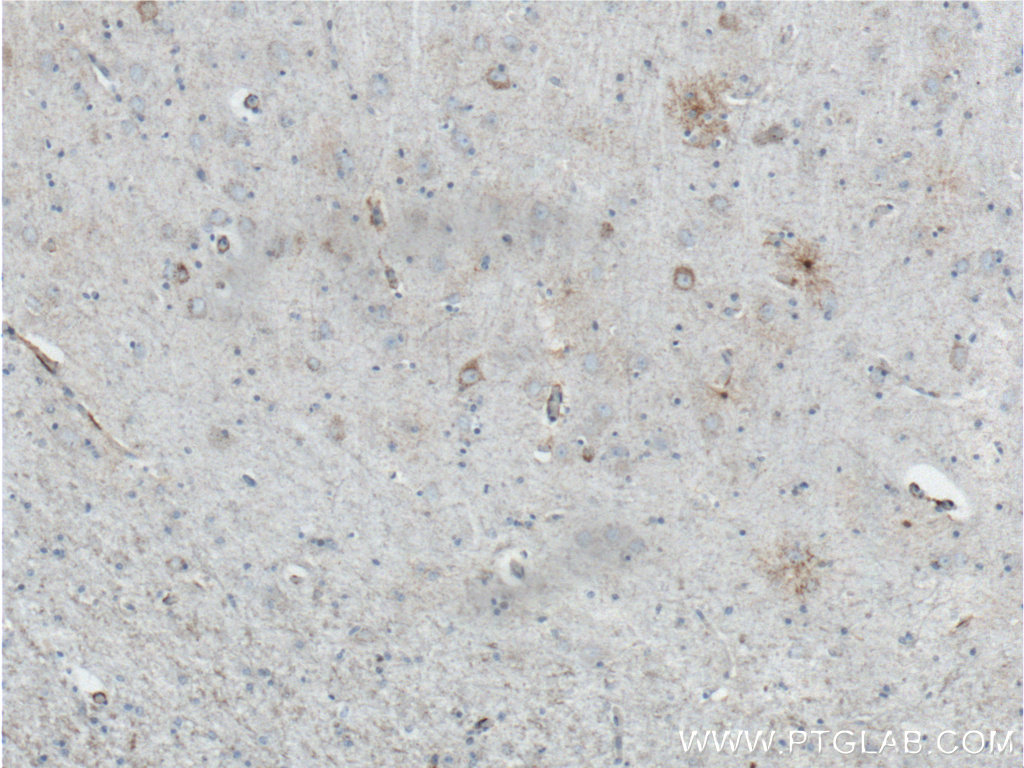 IHC staining of human brain using 60171-1-Ig (same clone as 60171-1-PBS)