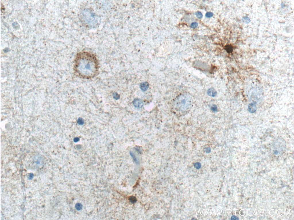 IHC staining of human brain using 60171-1-Ig (same clone as 60171-1-PBS)