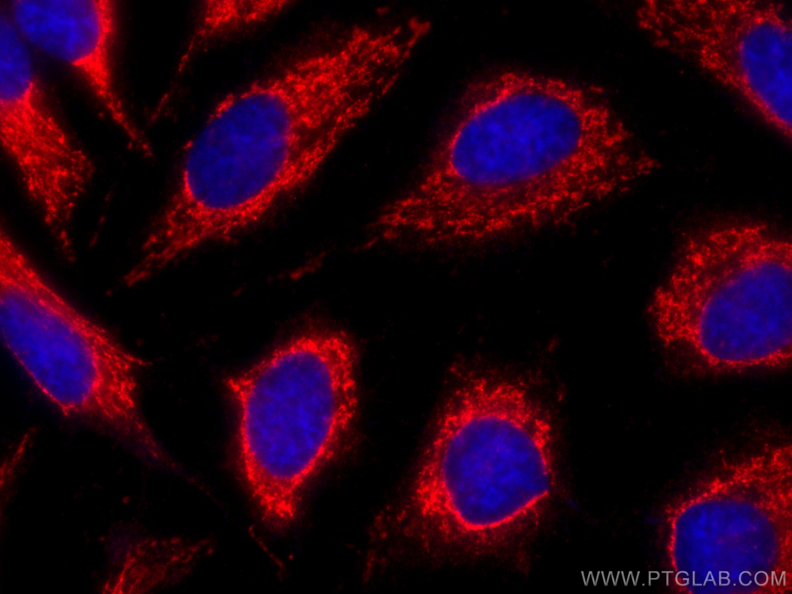 IF Staining of HeLa using CL594-60171