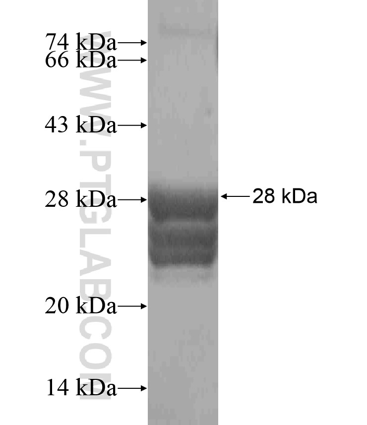 ALDH1A1 fusion protein Ag17358 SDS-PAGE