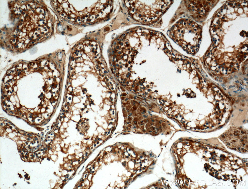 IHC staining of human testis using 13951-1-AP