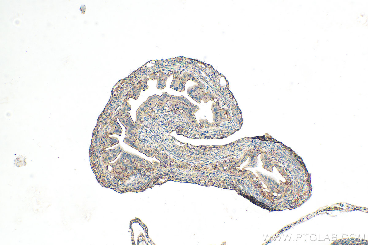 IHC staining of mouse ovary using 13951-1-AP