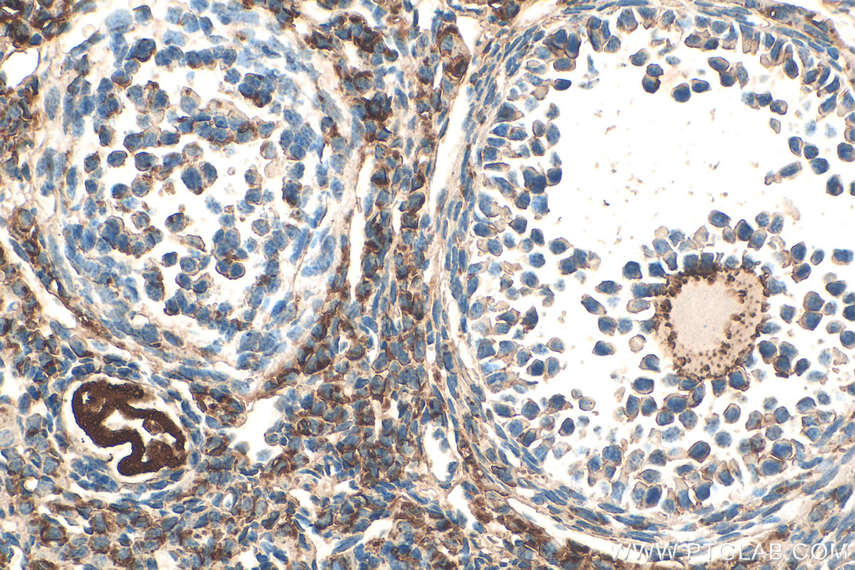 IHC staining of mouse ovary using 13951-1-AP