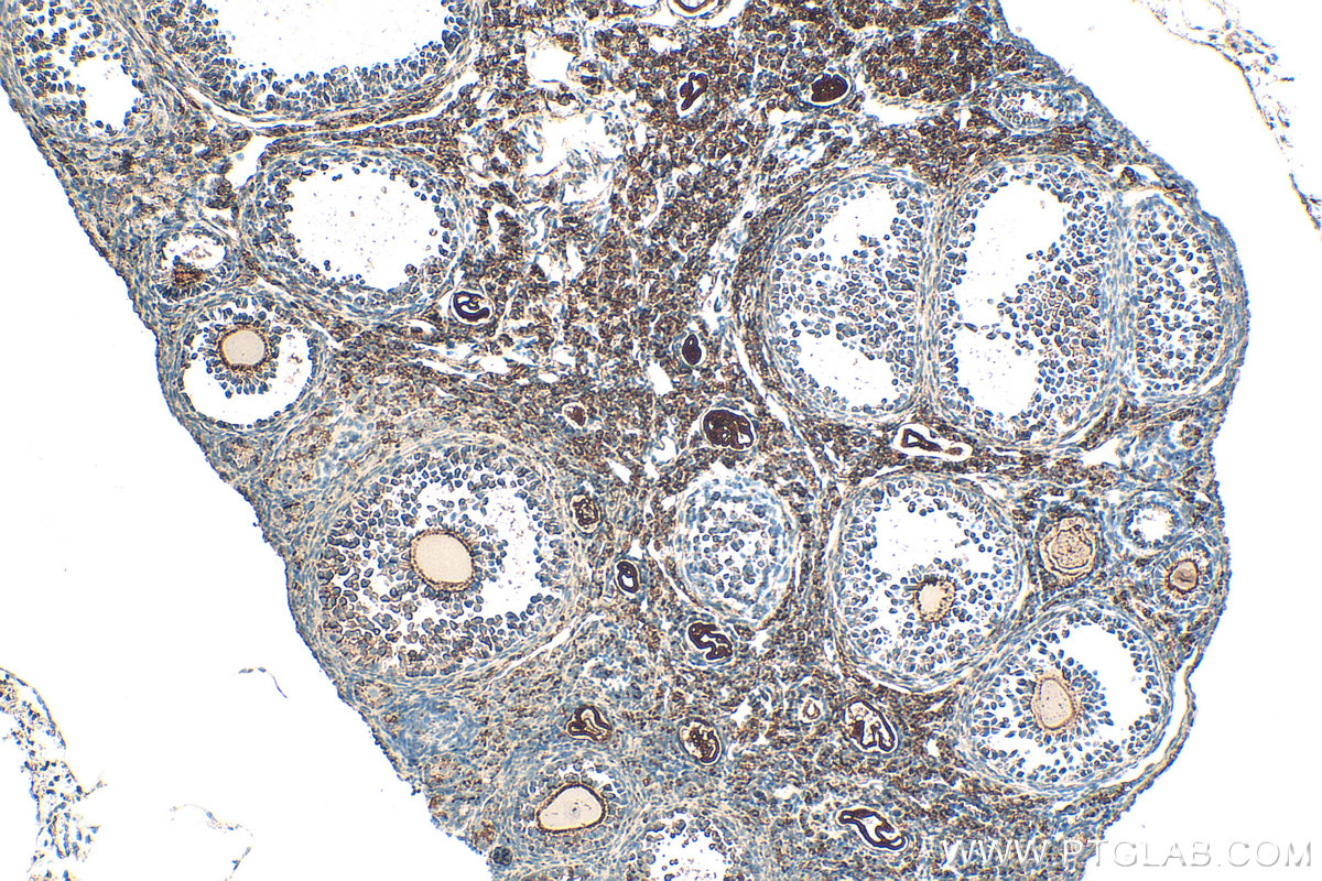 IHC staining of mouse ovary using 13951-1-AP
