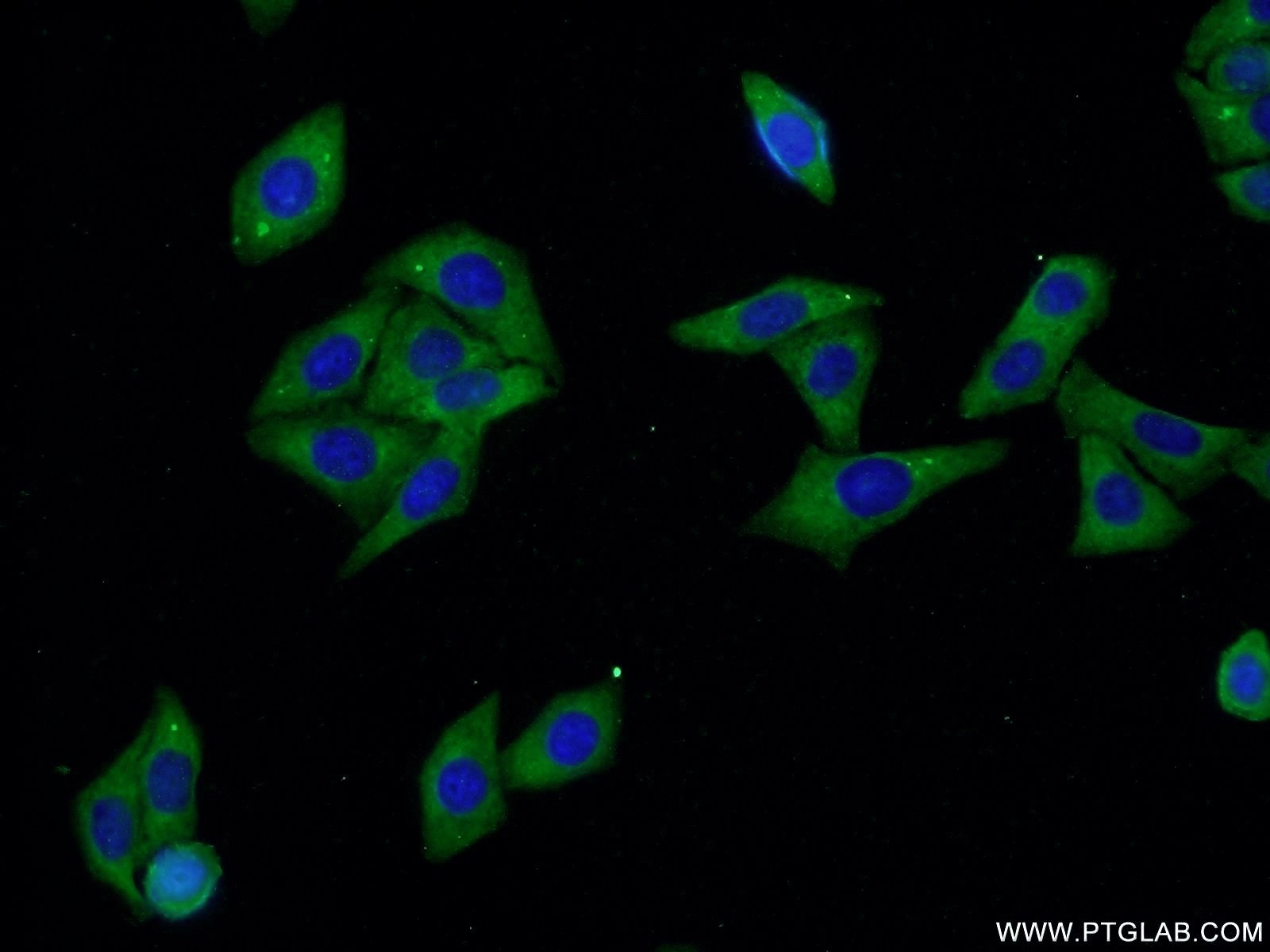 IF Staining of HepG2 using 25167-1-AP