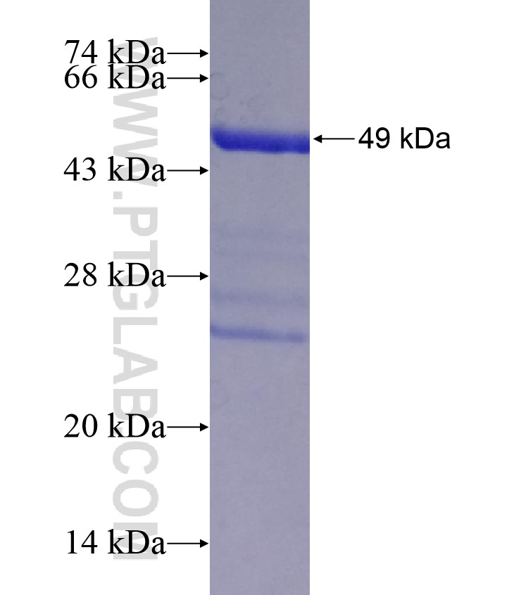 ALDH1A3 fusion protein Ag18311 SDS-PAGE ALDH1A3 fusion protein Ag18311 SDS-PAGE