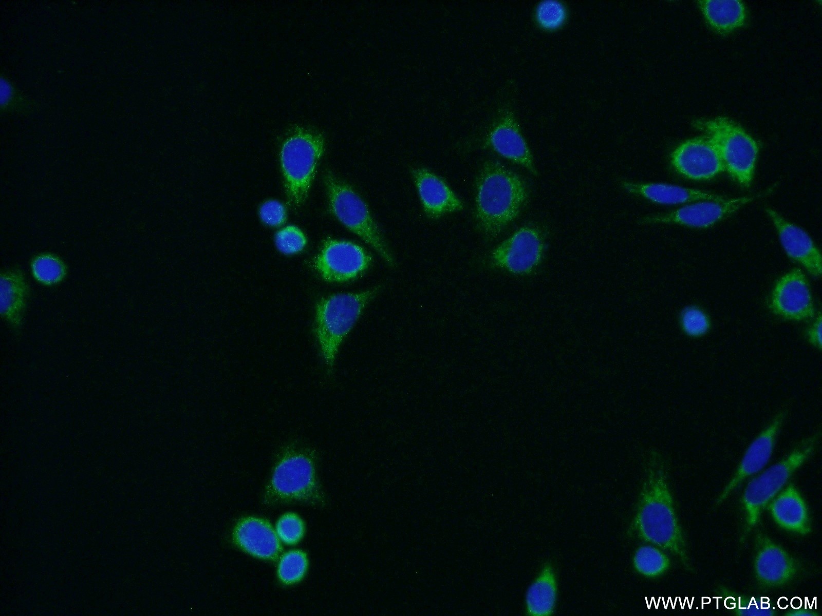 IF Staining of HepG2 using 15560-1-AP