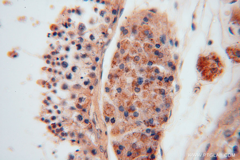 IHC staining of human testis using 15560-1-AP