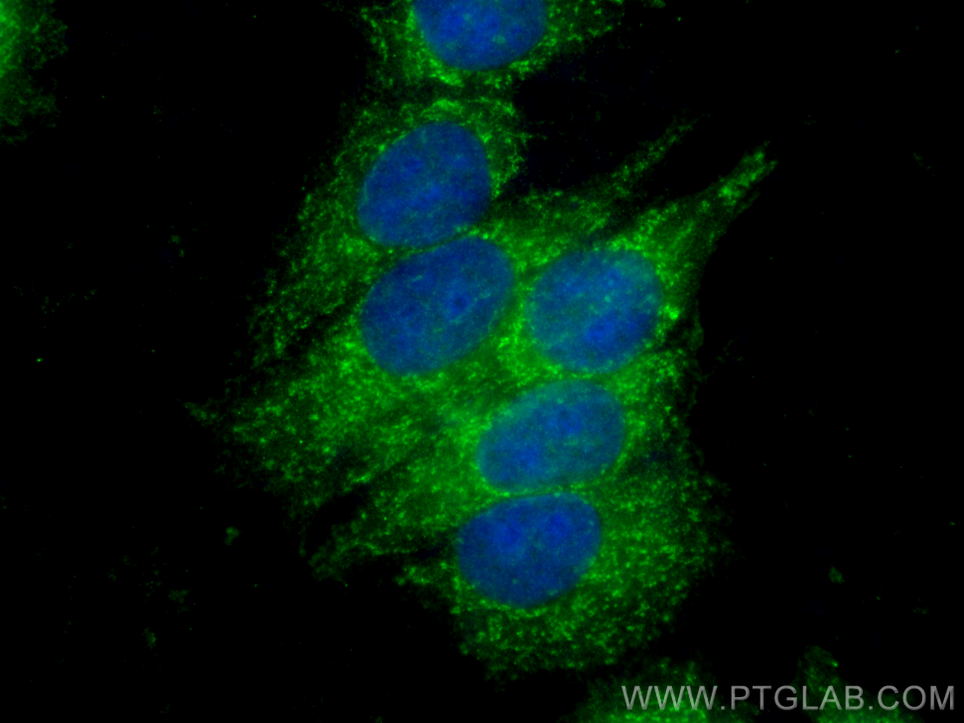 IF Staining of MCF-7 using 22220-1-AP