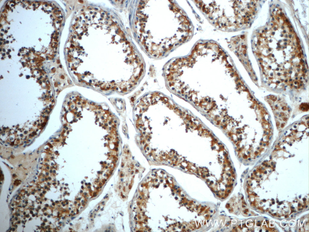 IHC staining of human testis using 22220-1-AP