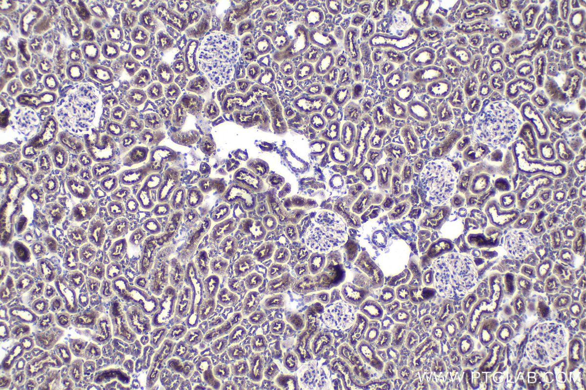 IHC staining of rat kidney using 22220-1-AP