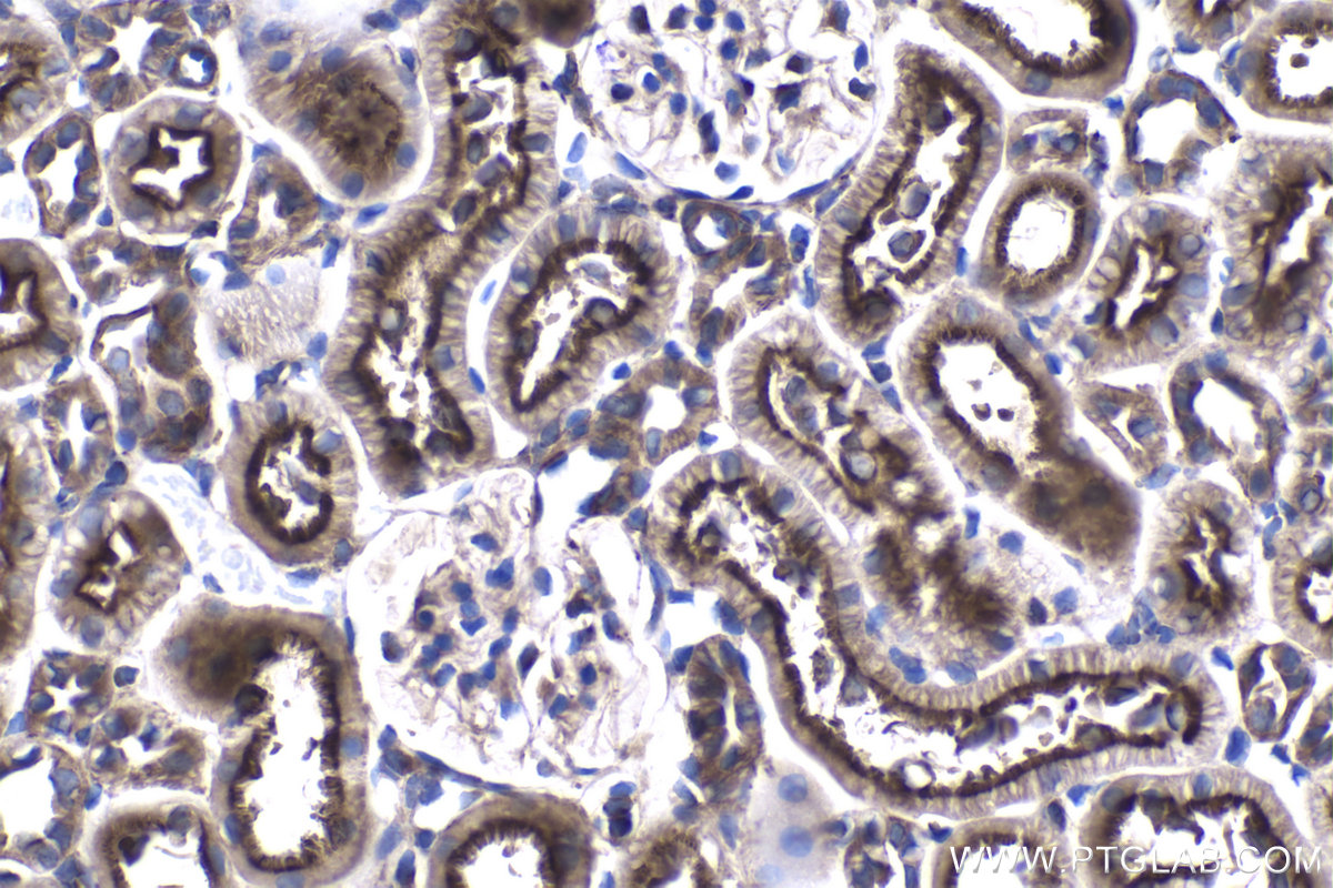 IHC staining of rat kidney using 22220-1-AP