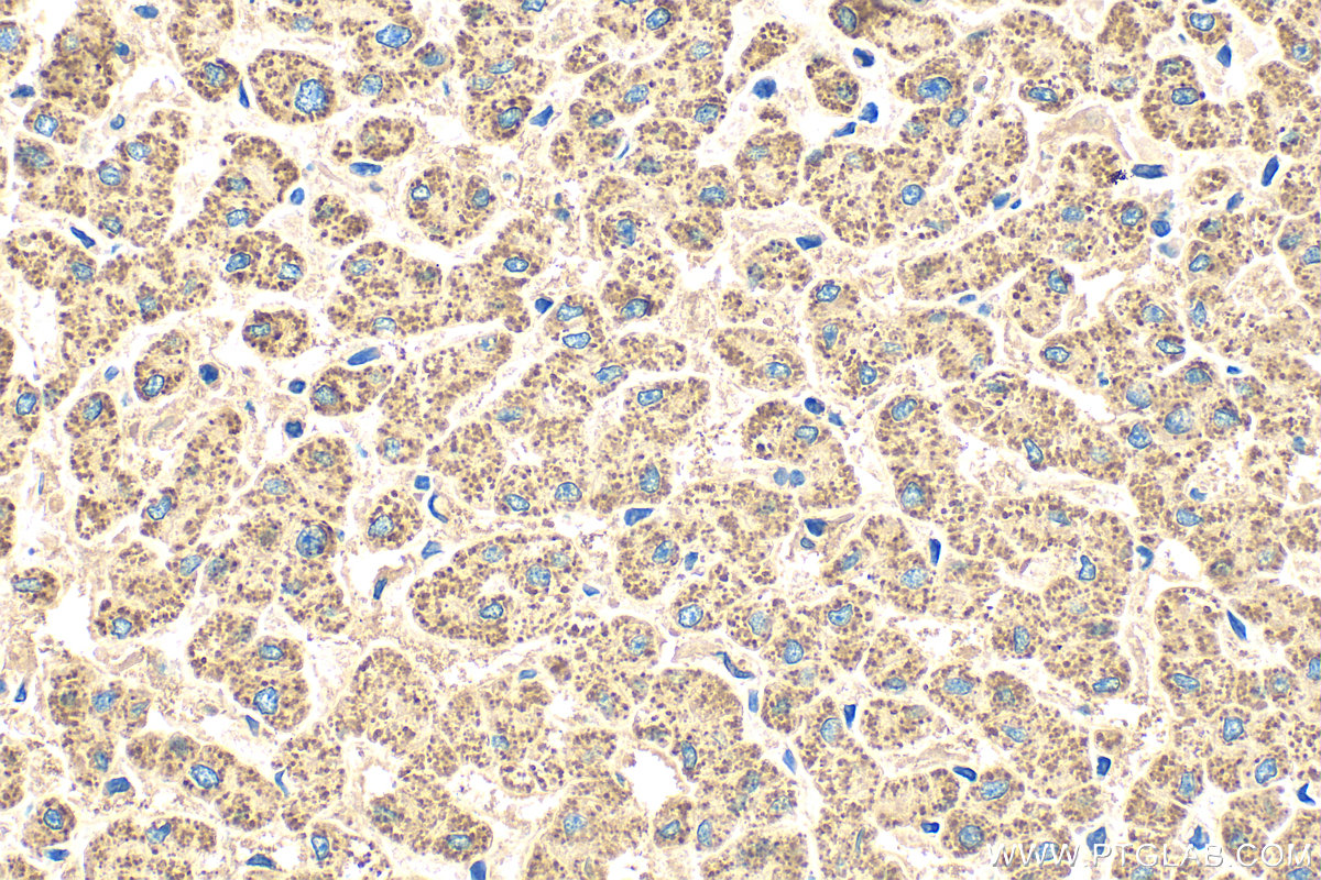 IHC staining of human liver using 22220-1-AP