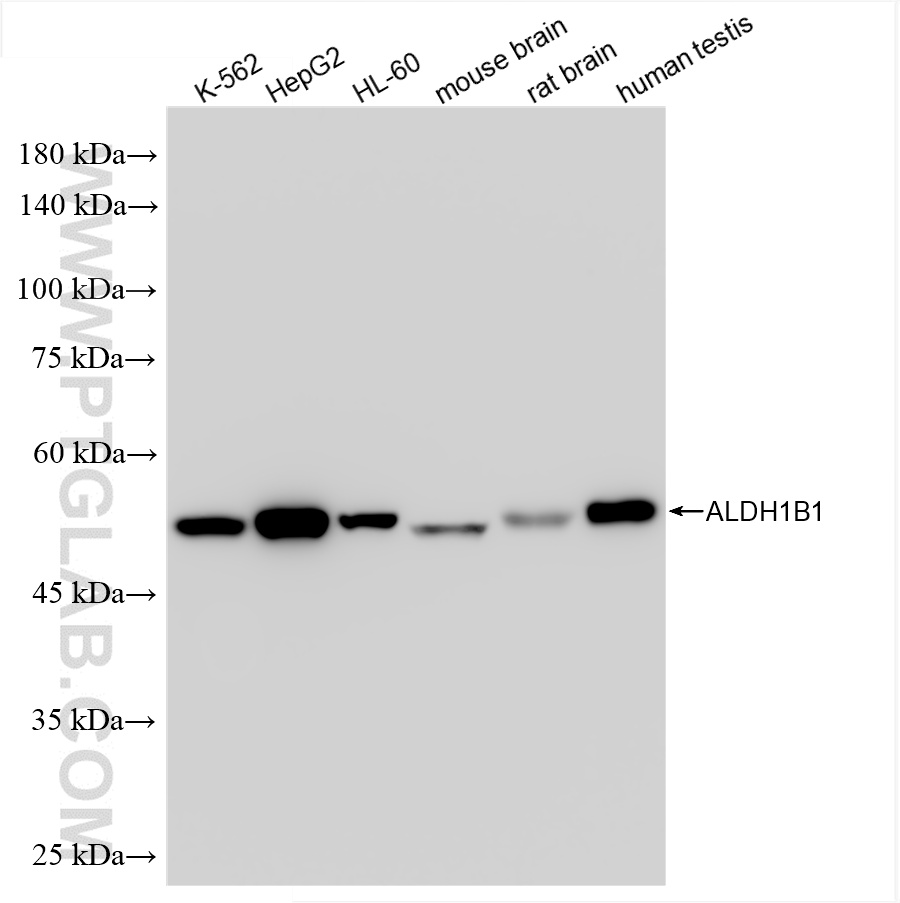 WB analysis using 85426-4-RR (same clone as 85426-4-PBS)