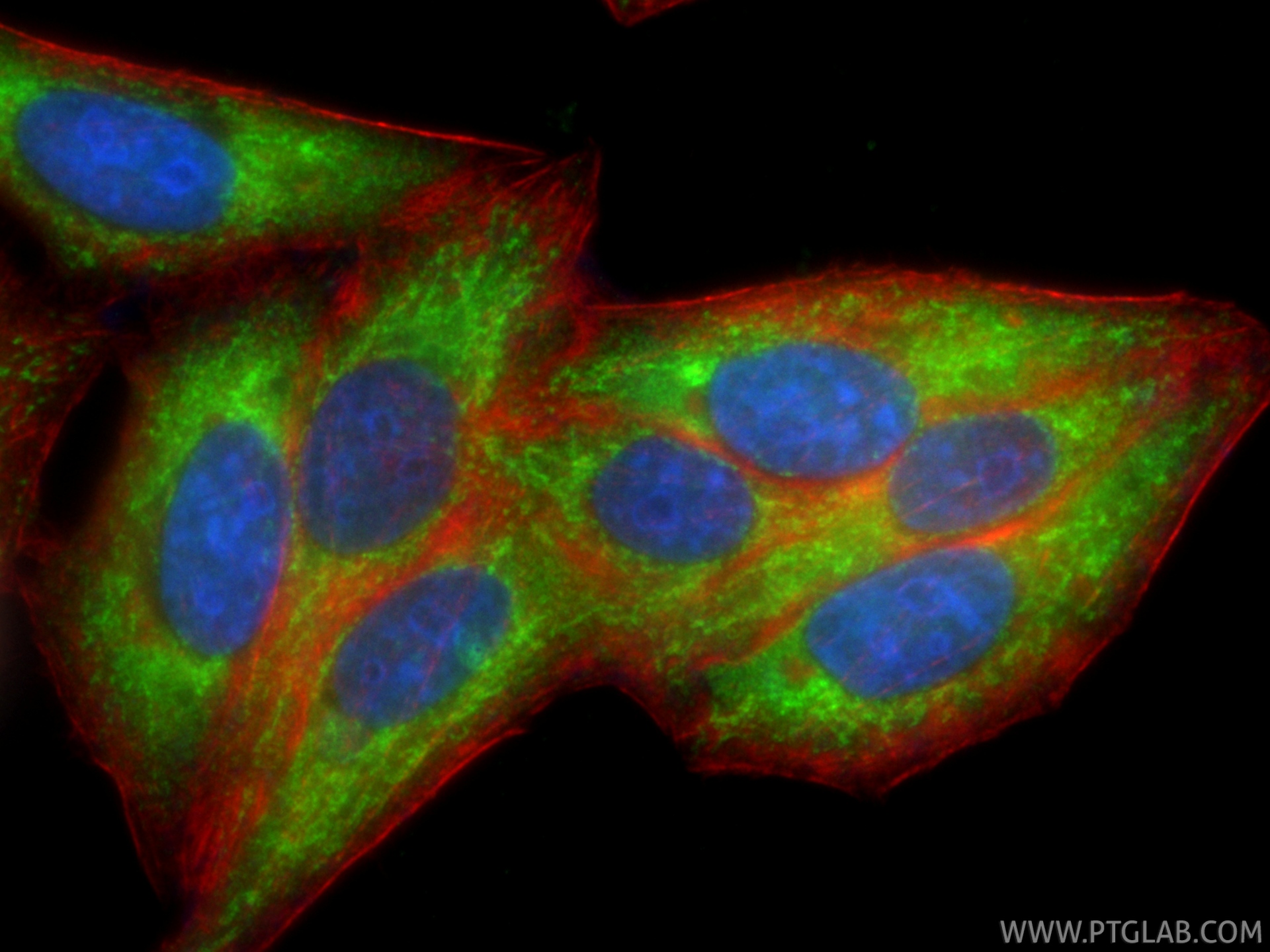 IF Staining of HepG2 using CL488-85426-2 IF Staining of HepG2 using CL488-85426-2
