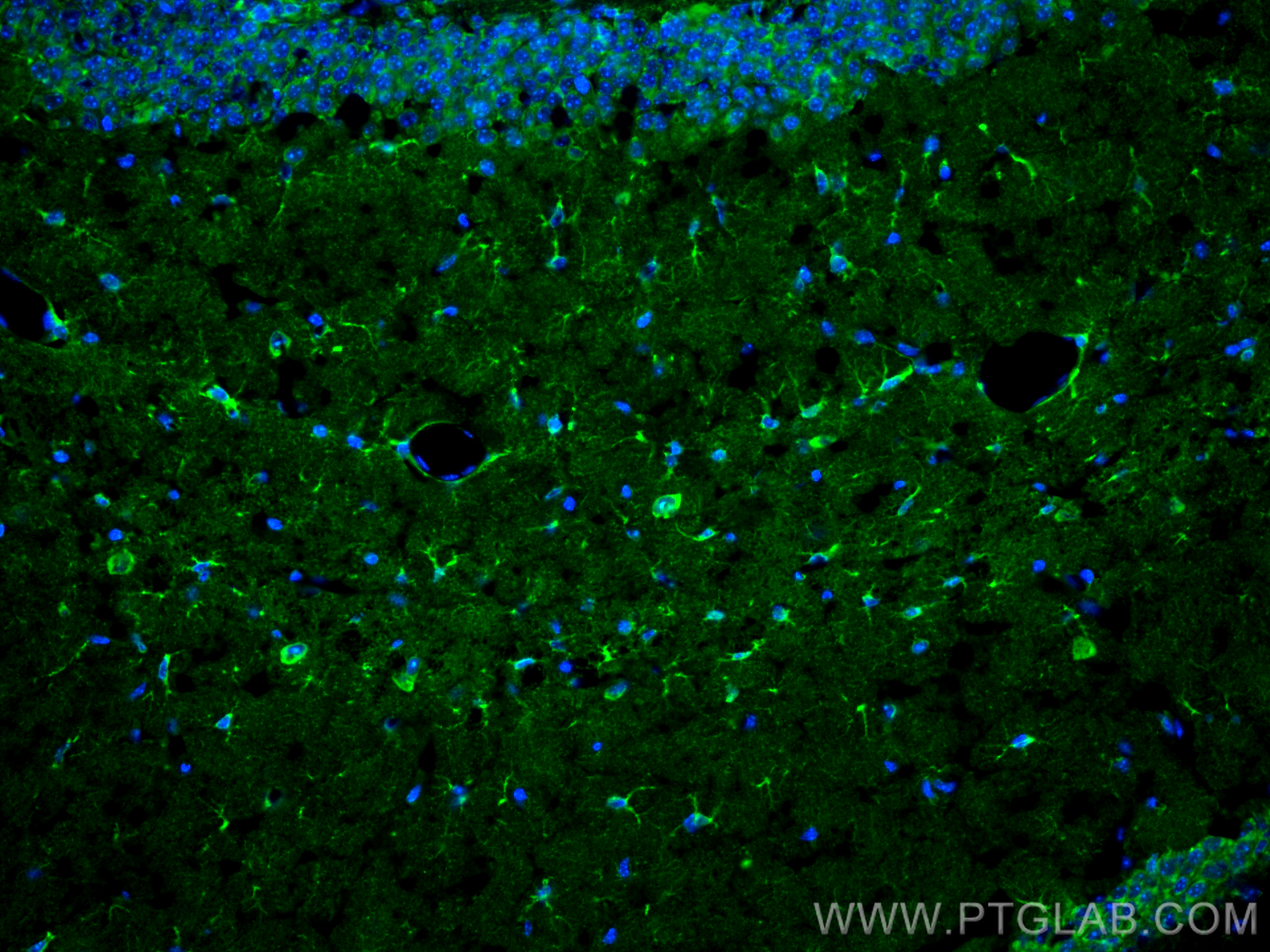 IF Staining of mouse brain using 17390-1-AP