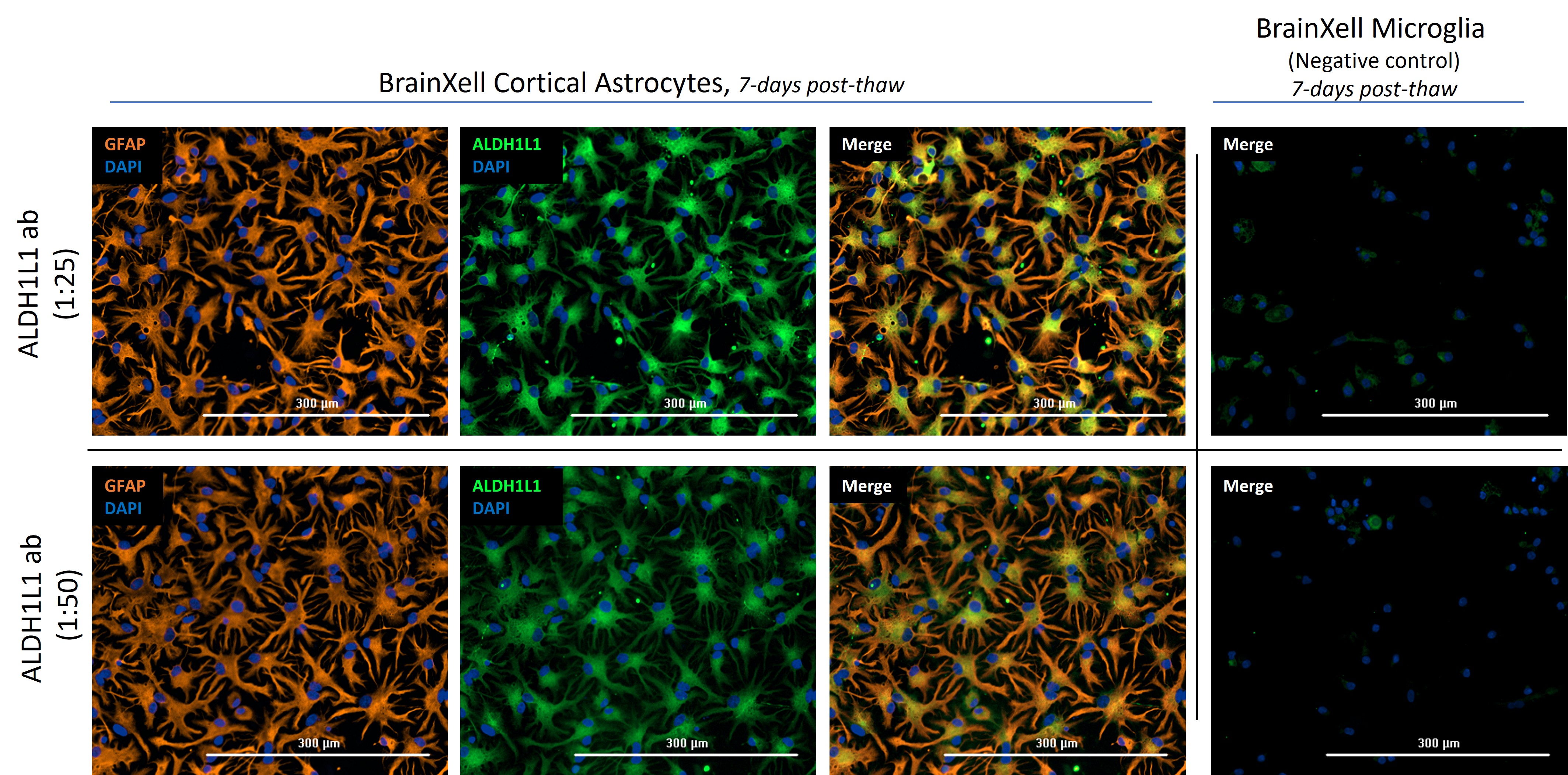 IF Staining of hiPSC-derived cortical astrocytes (7 DIV) using 17390-1-AP (same clone as 17390-1-PBS)